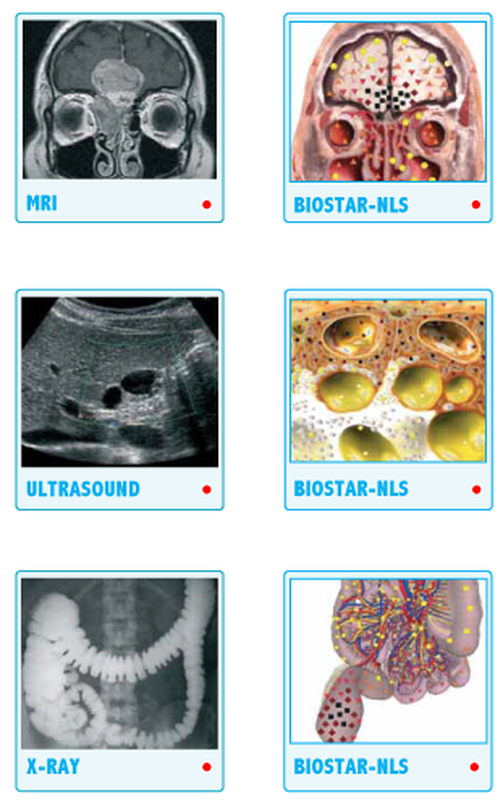 NLS measurement comparison
